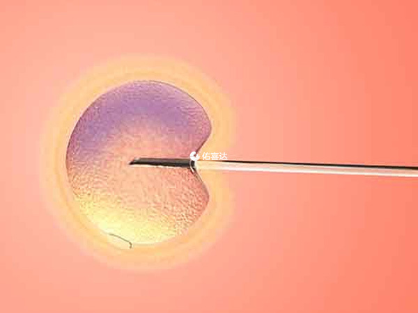 显微取精的精子需要进行icis受精