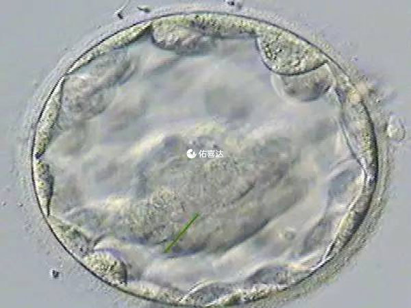 囊胚测到弱阳后不加深可能是胚胎发育异常