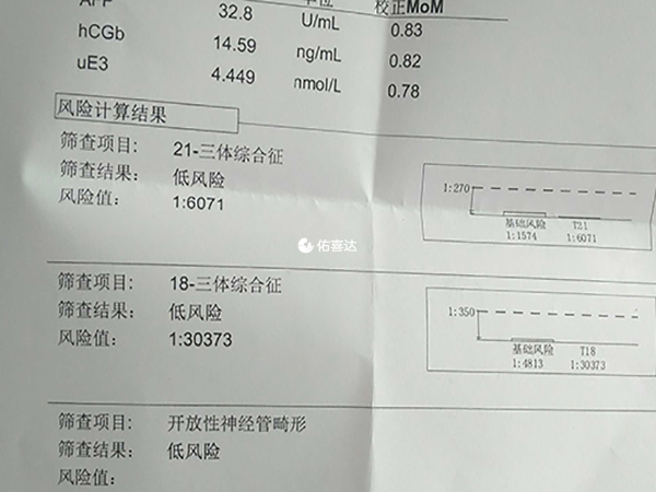 35歲的高齡孕婦更容易生下唐氏兒