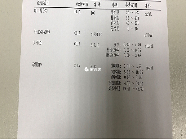 B超数据上还会有宝宝的股骨长度