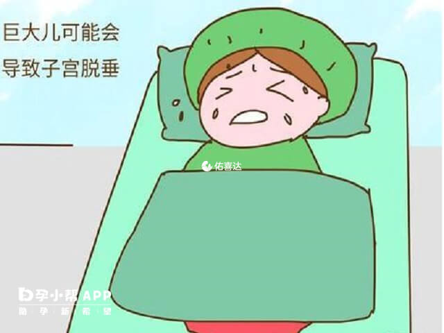 孩子过大可能会导致子宫脱垂