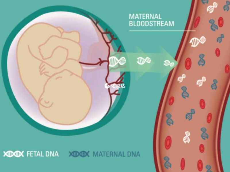 无创DNA产前检测技术
