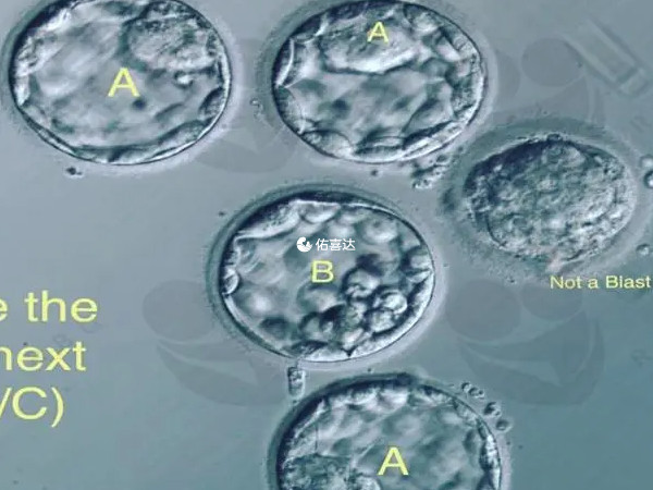 在D5期中bb以上就被称之为优质囊胚