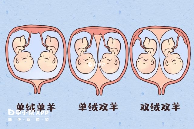 单绒和双绒双胞胎示意图