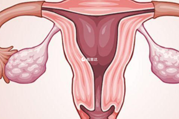 宮腔鏡檢查能確定內膜是否存在粘連