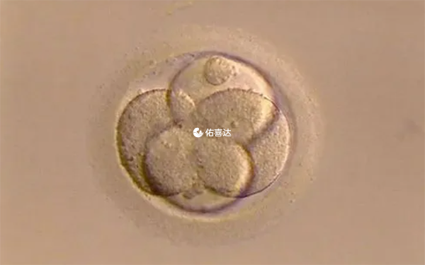 养囊能否成功与精子和卵子的质量都有关系