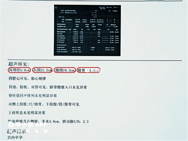 四维彩超报告单