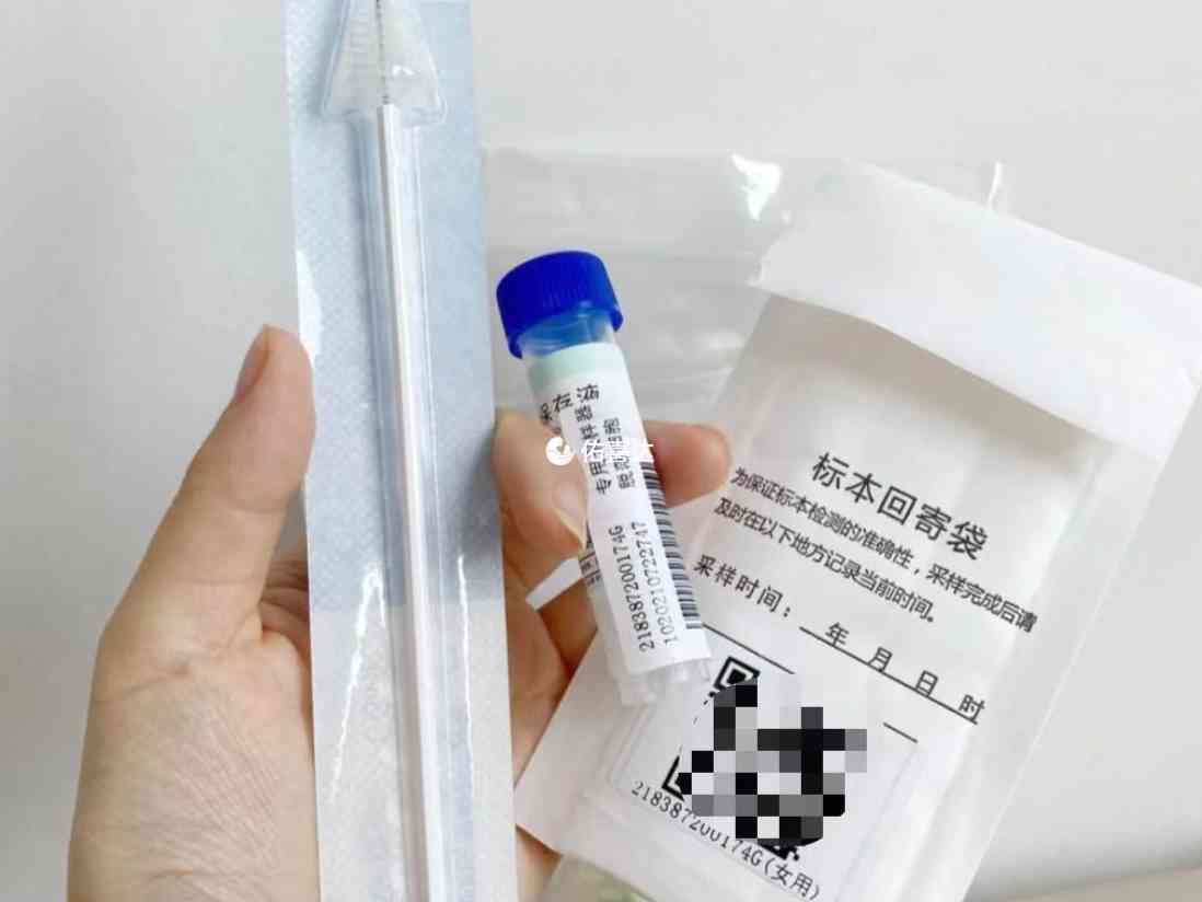 有性行為的女性有必要檢查HPV和TCT