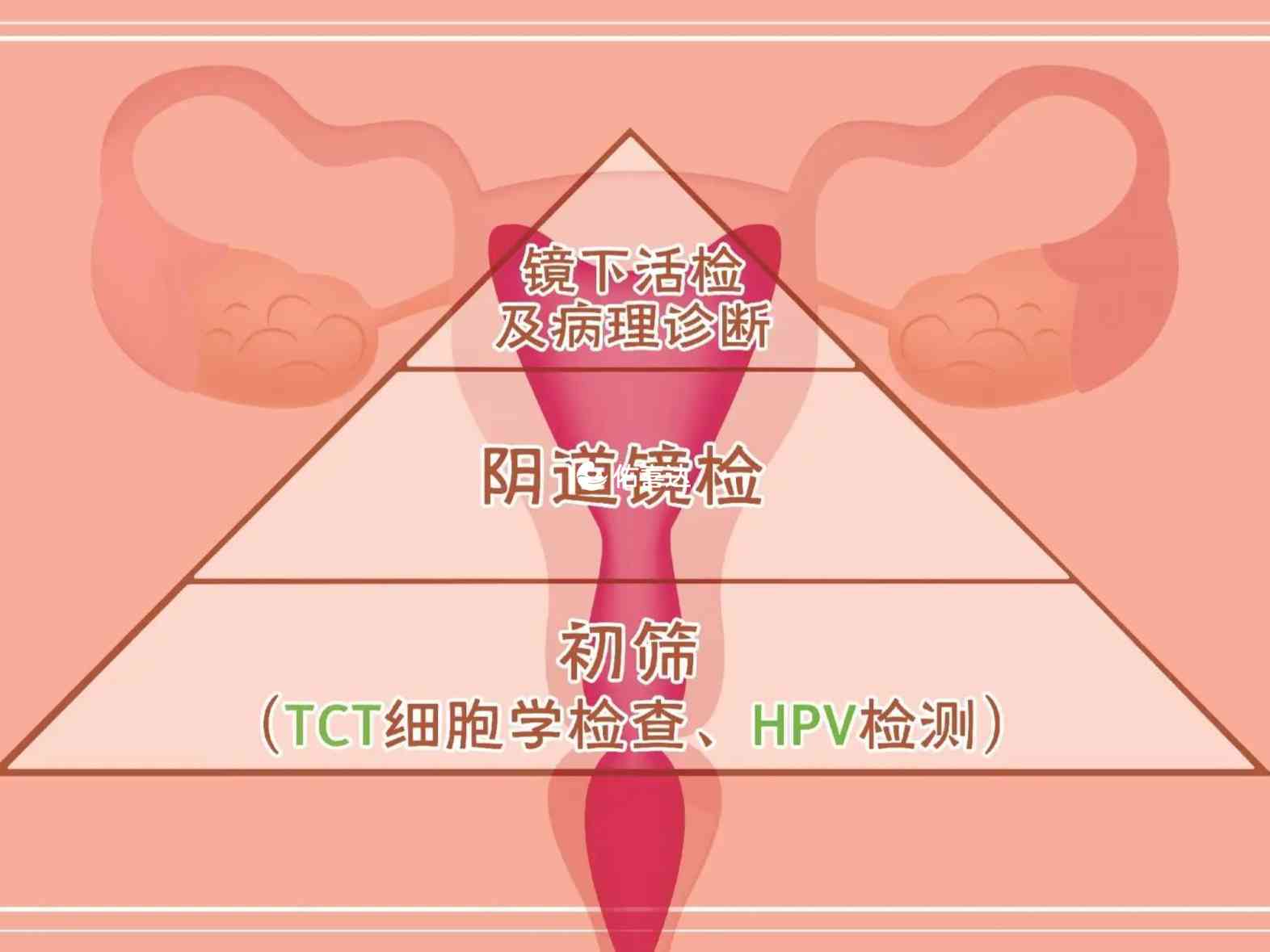 不建议年轻女性检查hpv