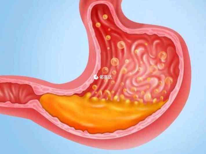 兒童吃奧司他韋會讓腸胃道受到刺激