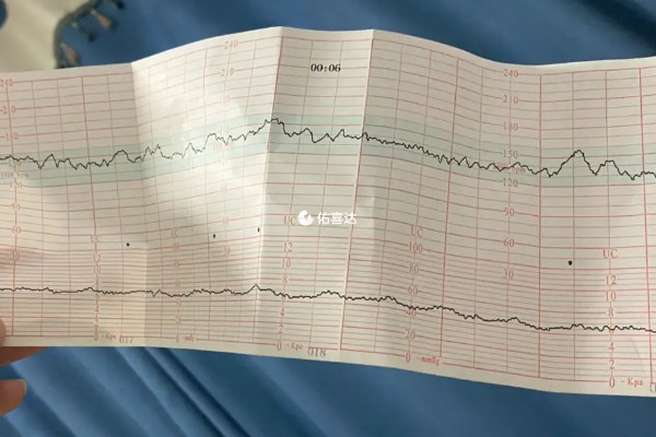胎心监护可以评估胎儿的健康状况