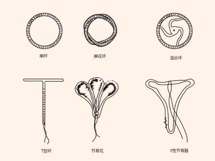 節育環的避孕效果非常好