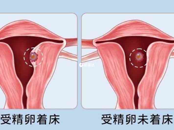 女性生化妊娠熱門疑問解讀