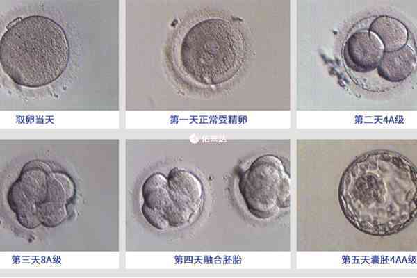 优胚和囊胚移植有3个区别