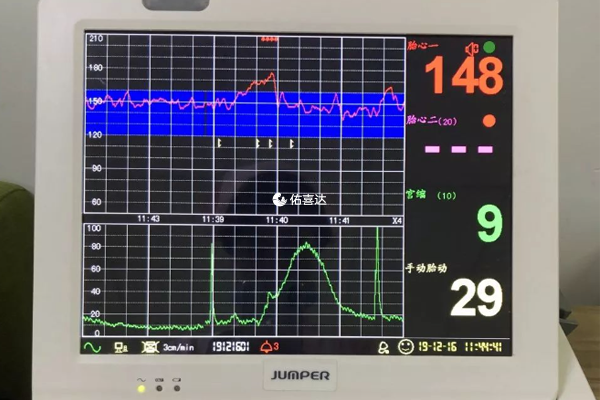 孕期胎心监护3次不过关住院是为了更方便治疗