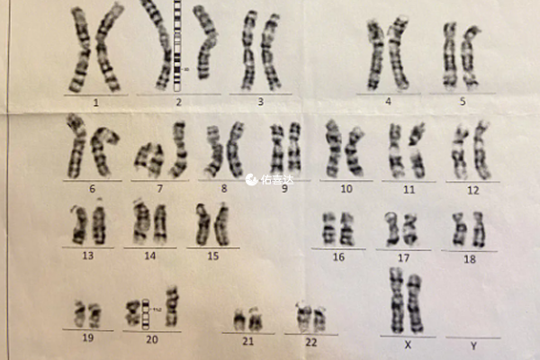 医生不建议查染色体原因分析