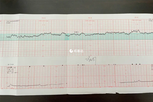 孕期胎心监护三次不过要住院原因分析
