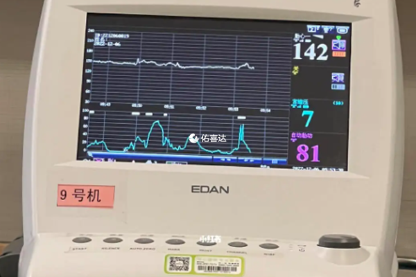 胎心監護意義及不合格原因分析