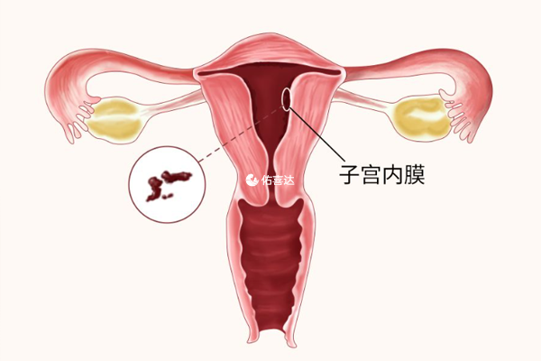 子宫内膜18mm是否正常因人而异