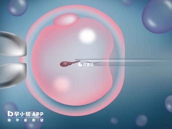 內膜異位不降調會影響試管移植